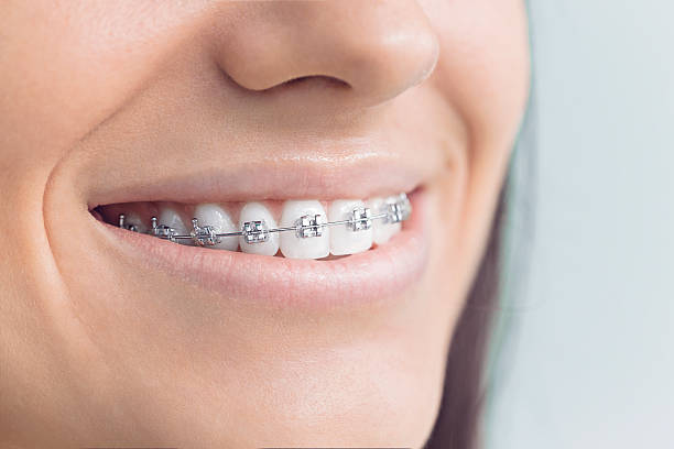 Best Full Mouth Reconstruction  in University Park, TX